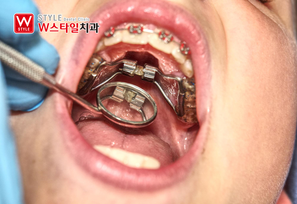 논현역교정치과
