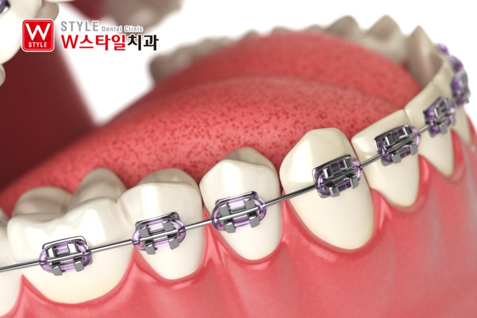 논현역교정치과