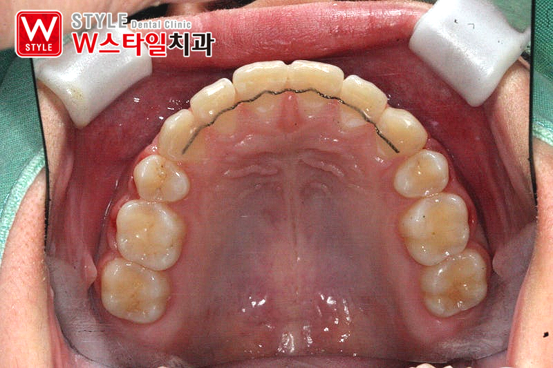 논현역교정치과