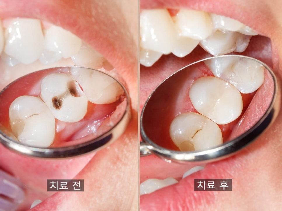 논현역교정치과
